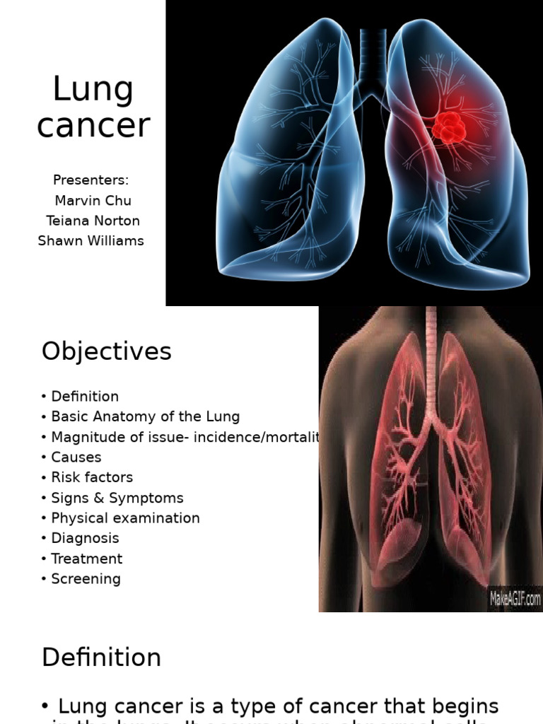 Lung Cancer | PDF