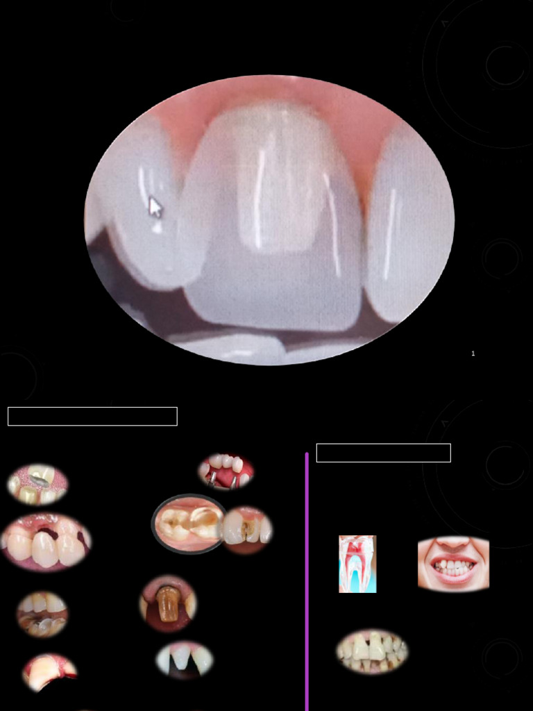 Coronas DOC-20240604-WA0000 - 240604 - 084332 | PDF | Materiales