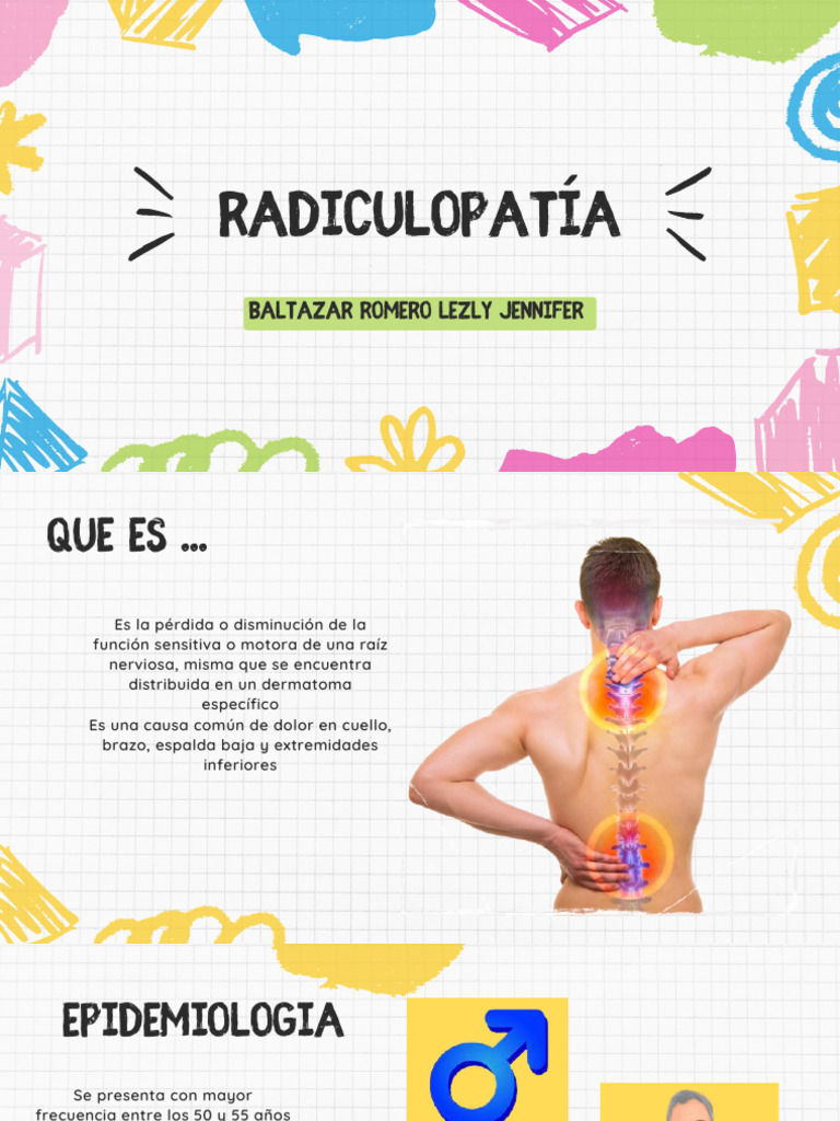 Radiculopatia | PDF