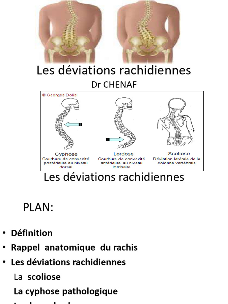 6-Déviations Rachidiennes | PDF