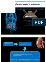 Nefropatia de Cambios Mínimos