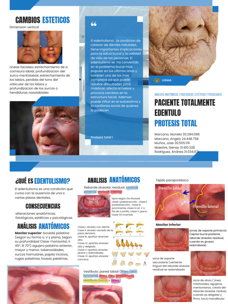 Implicaciones del Edentulismo Total | PDF | Diente | Ramas de Odontología