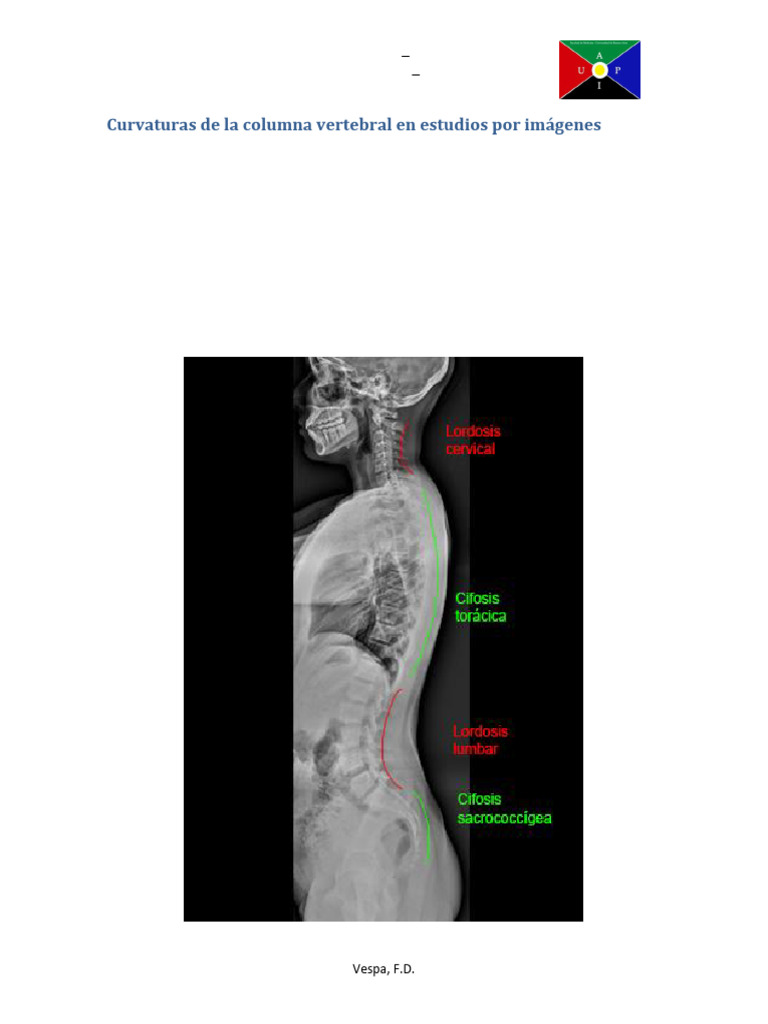 Curvaturas de La Columna Vertebral en Estudios Por Imágenes | PDF