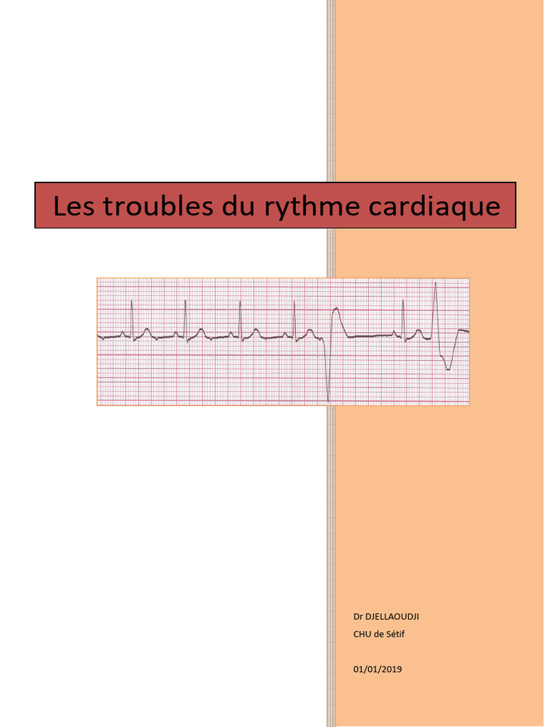 Troubles du rythme cardiaque : ESV et FA | PDF | Électrocardiographie ...