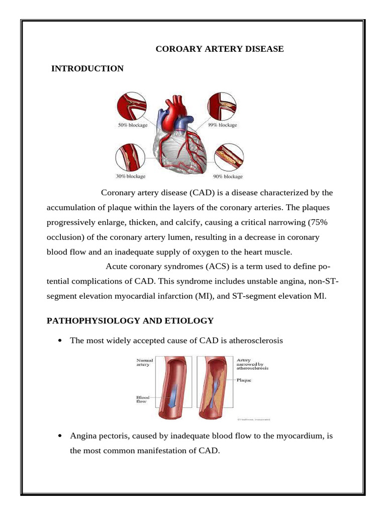 Coronary Artery Disease | PDF