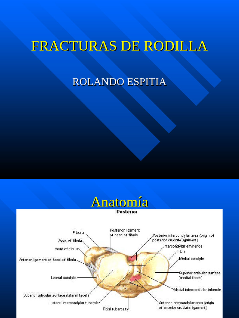 FRACTURAS DE RODILLA | PDF