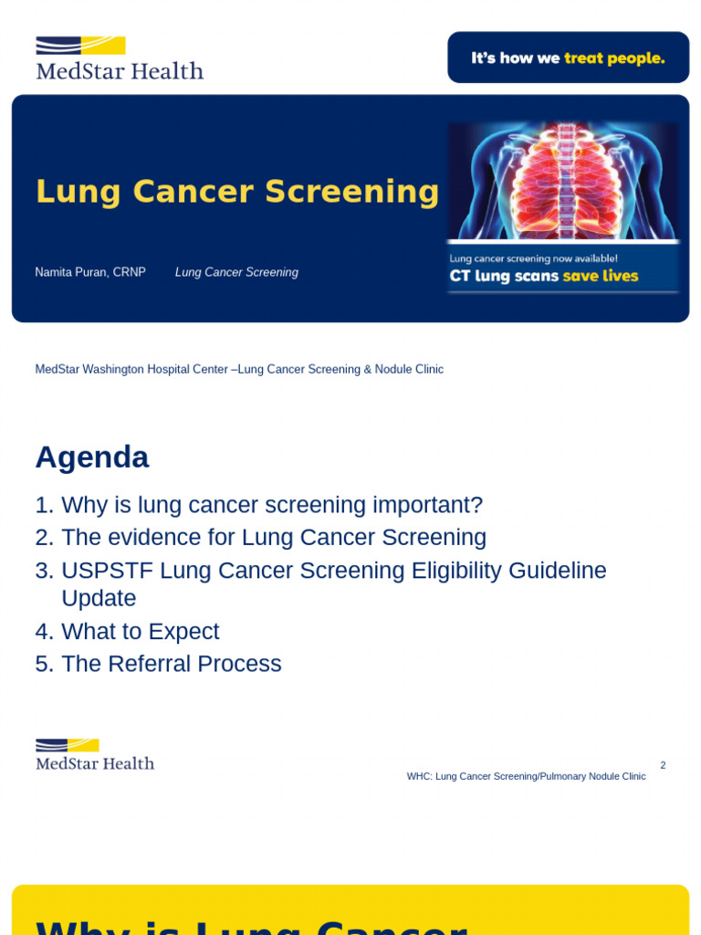 Lung Cancer Screening - MMG | PDF