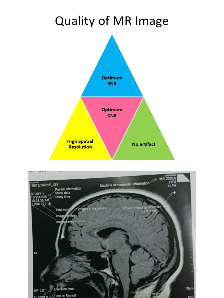 How To Adjust The Quality of The MRI | PDF