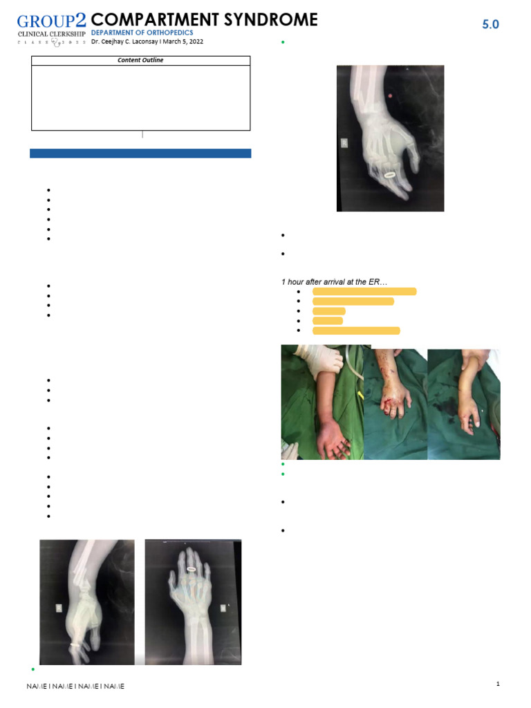 ORTHOPEDICS - Lecture - Trans 5 - Compartment Syndrome | PDF