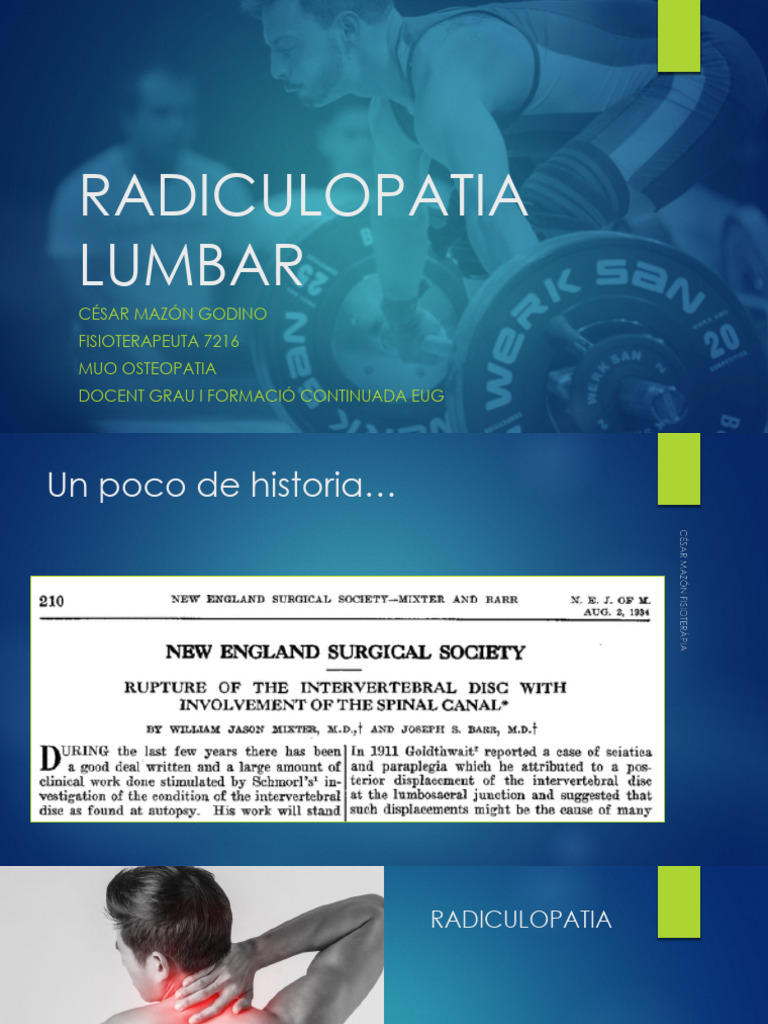 Radiculopatia Lumbar | PDF