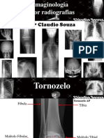 Aula 5 Imaginologia por radiografias- Tornozelo, calcaneo, pé e antepe- ProfºClaudio Souza