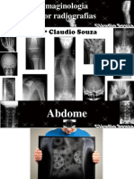 Aula 7 - Imaginologia Por Radiografias - Abdome. Profº Claudio Souza