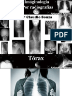 Aula 8 - Imaginologia Por Radiografias - Tórax. Profº Claudio Souza