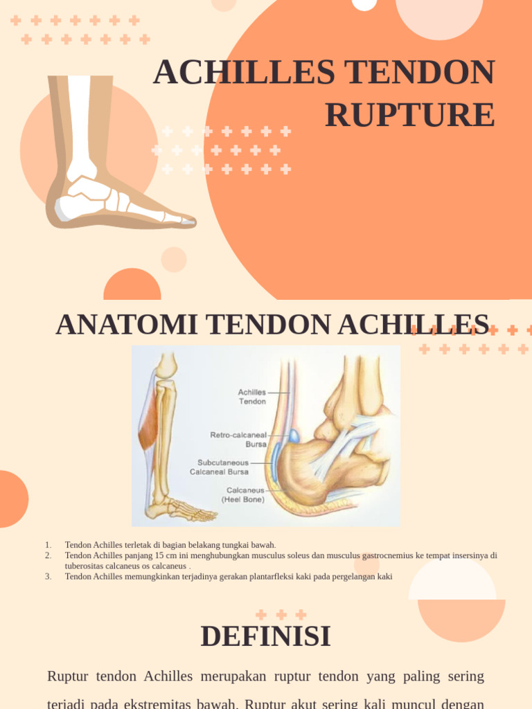 Achilles Tendon Rupture | PDF