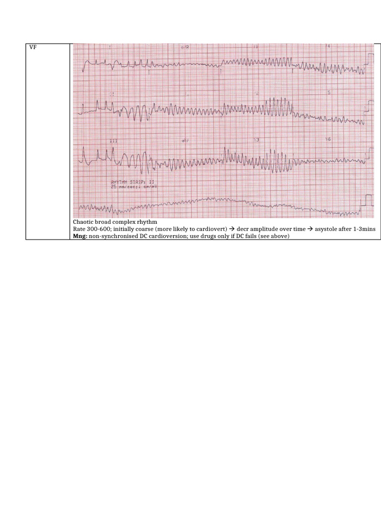 VF Fact Sheet | PDF