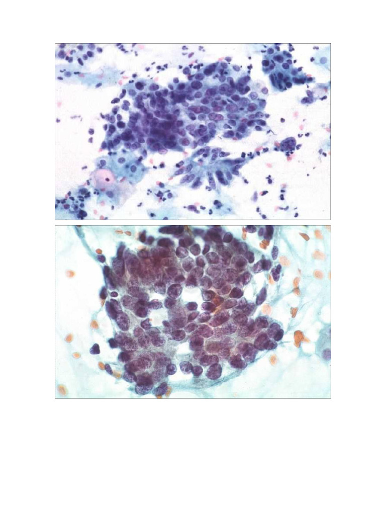 Comparativa de Imágenes | PDF
