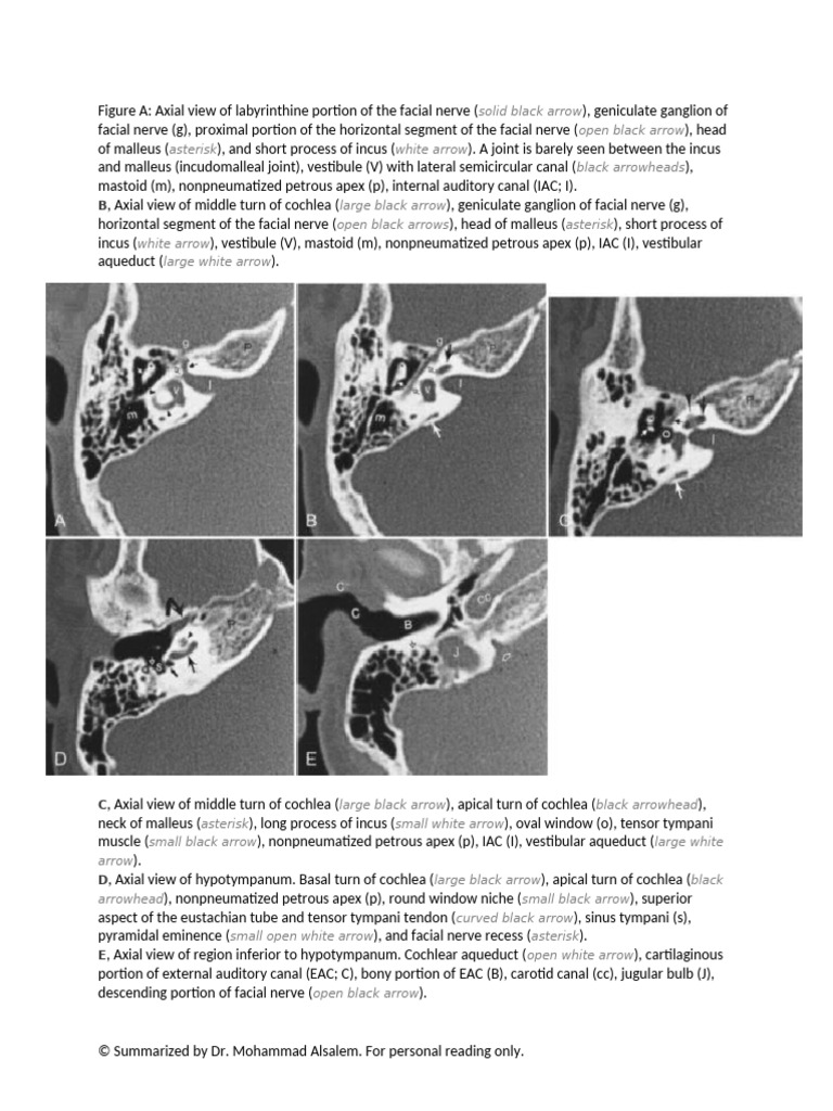 Normal CT Temporal | PDF