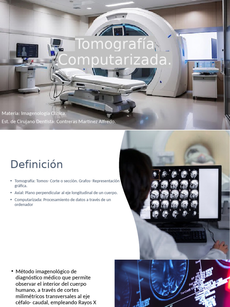 Tomografía Computarizada.: Materia: Imagenología Clínica. Est. de