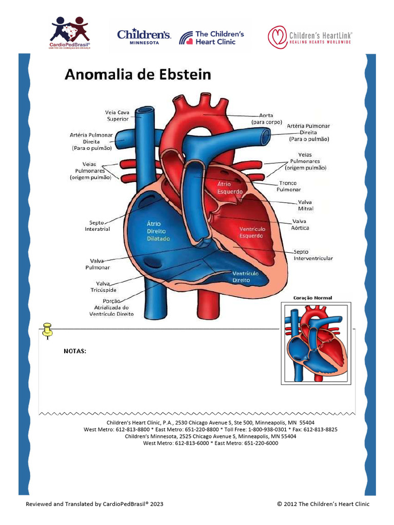 Anomalia de Ebstein | PDF