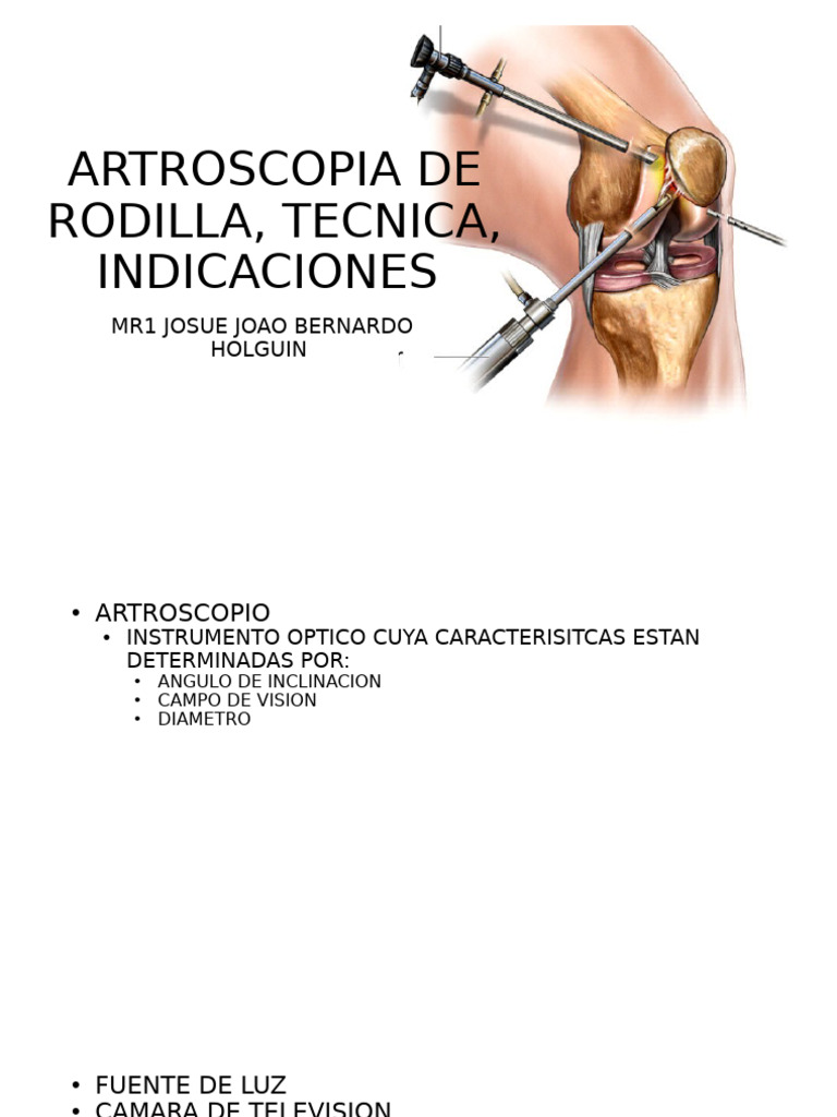 Artroscopia de Rodilla, Tecnica, Indicaciones | PDF