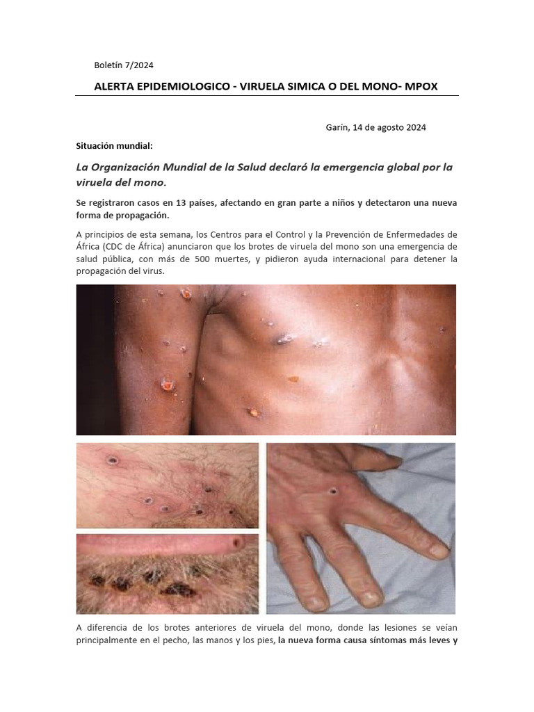 Alerta Epidemiologico-Mpox | PDF