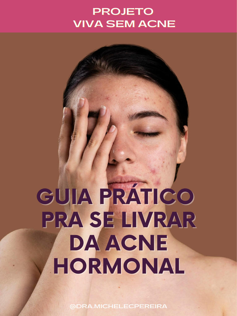 Acne hormonal presente apos formulario pdf