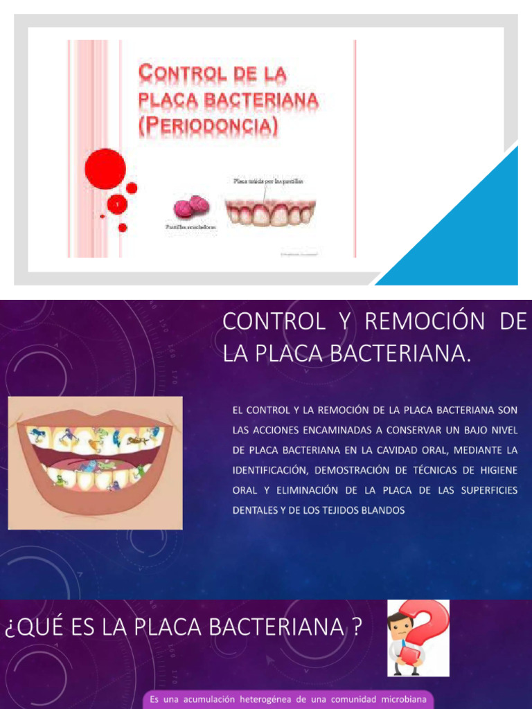 Control Placa | PDF