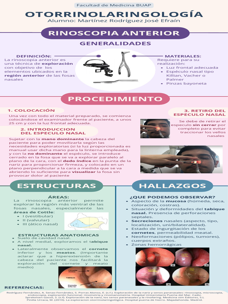 Infografía Rinoscopia Anterior | PDF