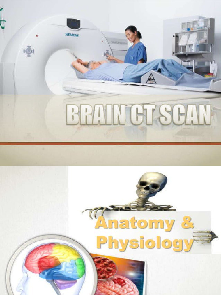 Brain CT Scan 30582326 | PDF