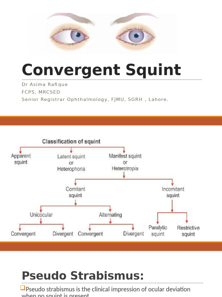 Squint 3 | PDF