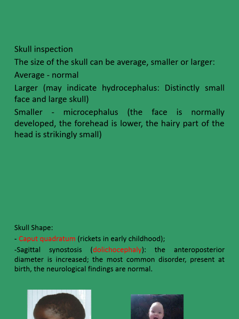 Medical Skull and Face Anomalies | PDF | Skull | Diseases And Disorders