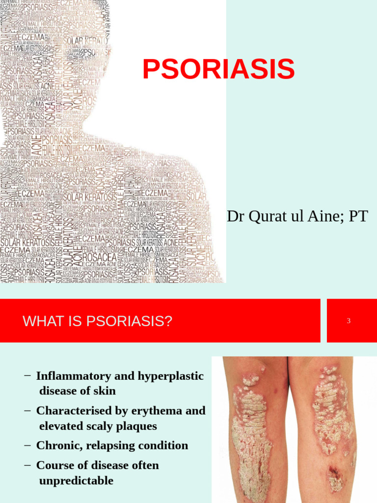 Psoriasis Summarized | PDF