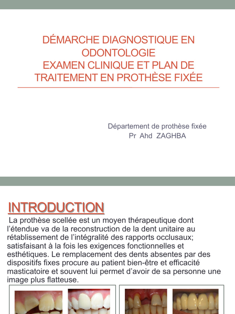 Lâ Examen Deì Marche Diagnostique Ne Protheì Se Fixeì e | PDF