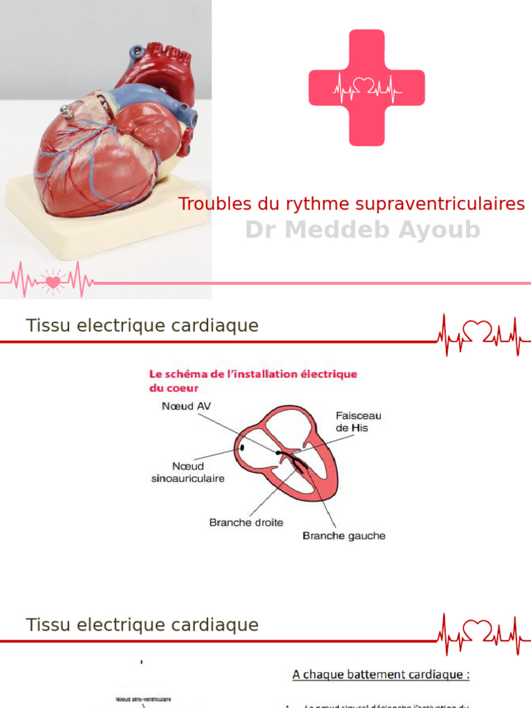 Troubles Du Rythme Supraventriculaires | PDF
