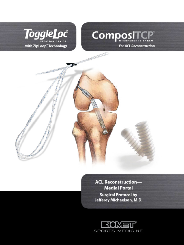 ToggleLoc para Reconstruccion LCA Biomet | PDF