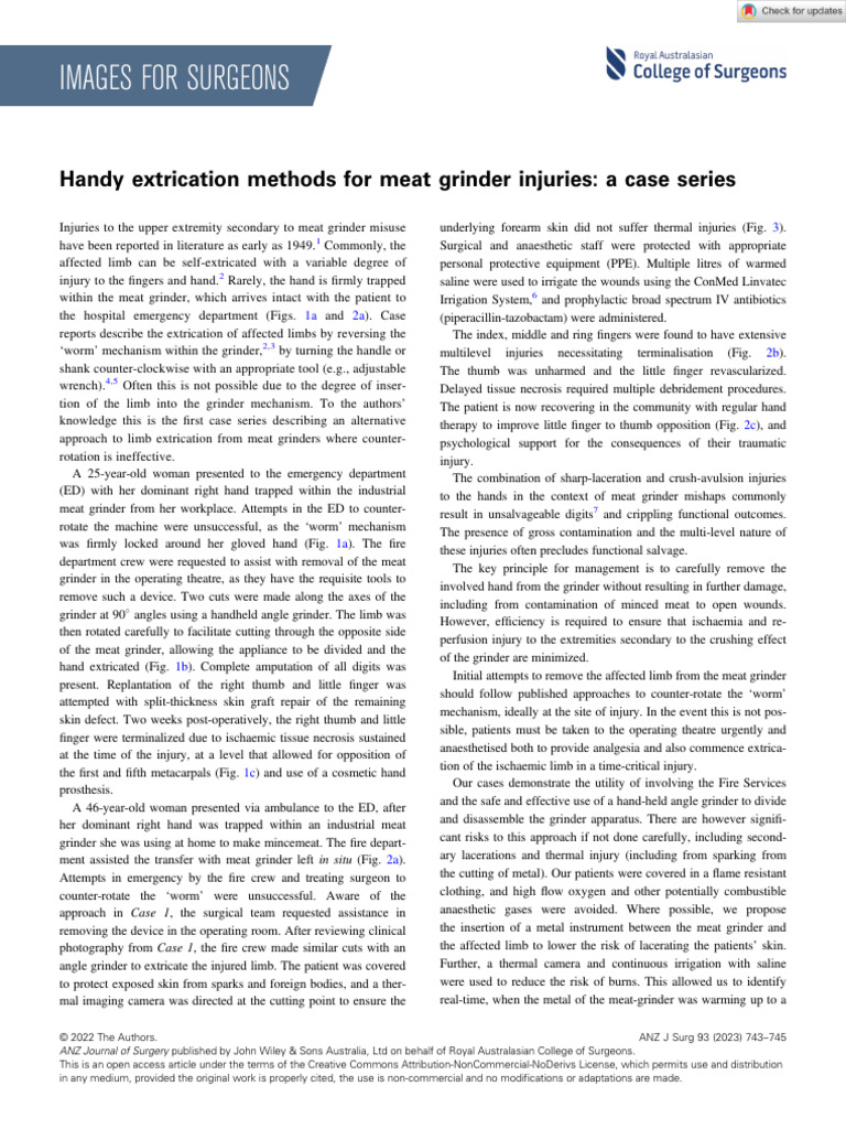 ANZ Journal of Surgery - 2022 - Gearing - Handy Extrication Methods For ...