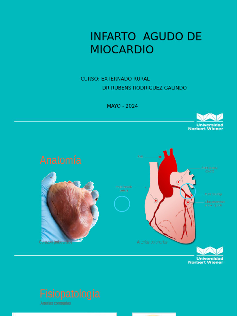 Infarto de Miocardio Final | PDF