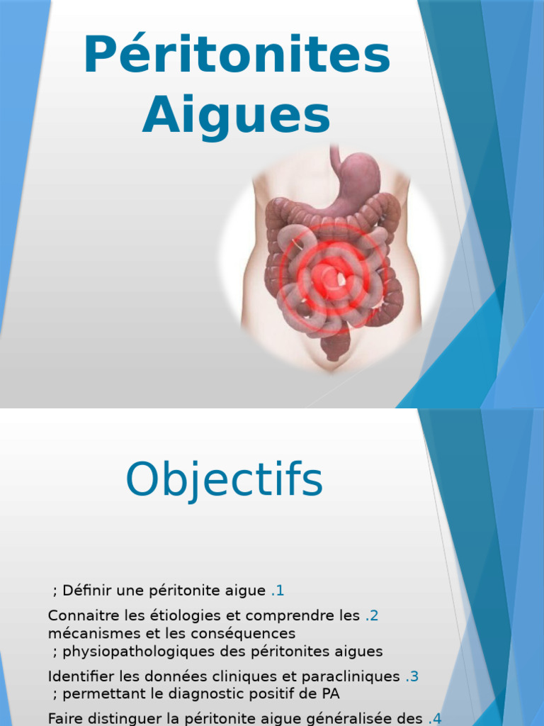 Peritonite Aigue | PDF