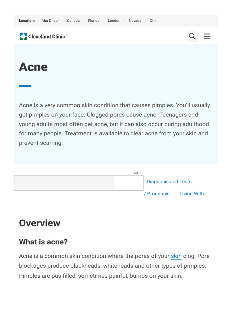 Acne - Types, Causes, Treatment & Prevention | PDF