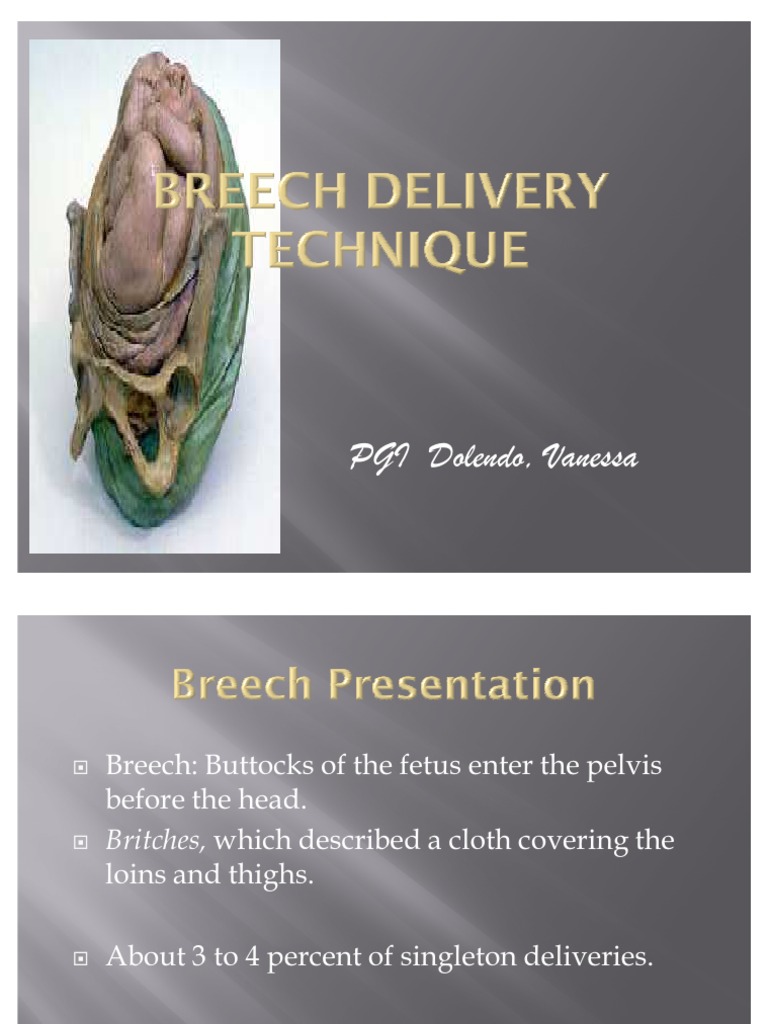 Breech presentation management image