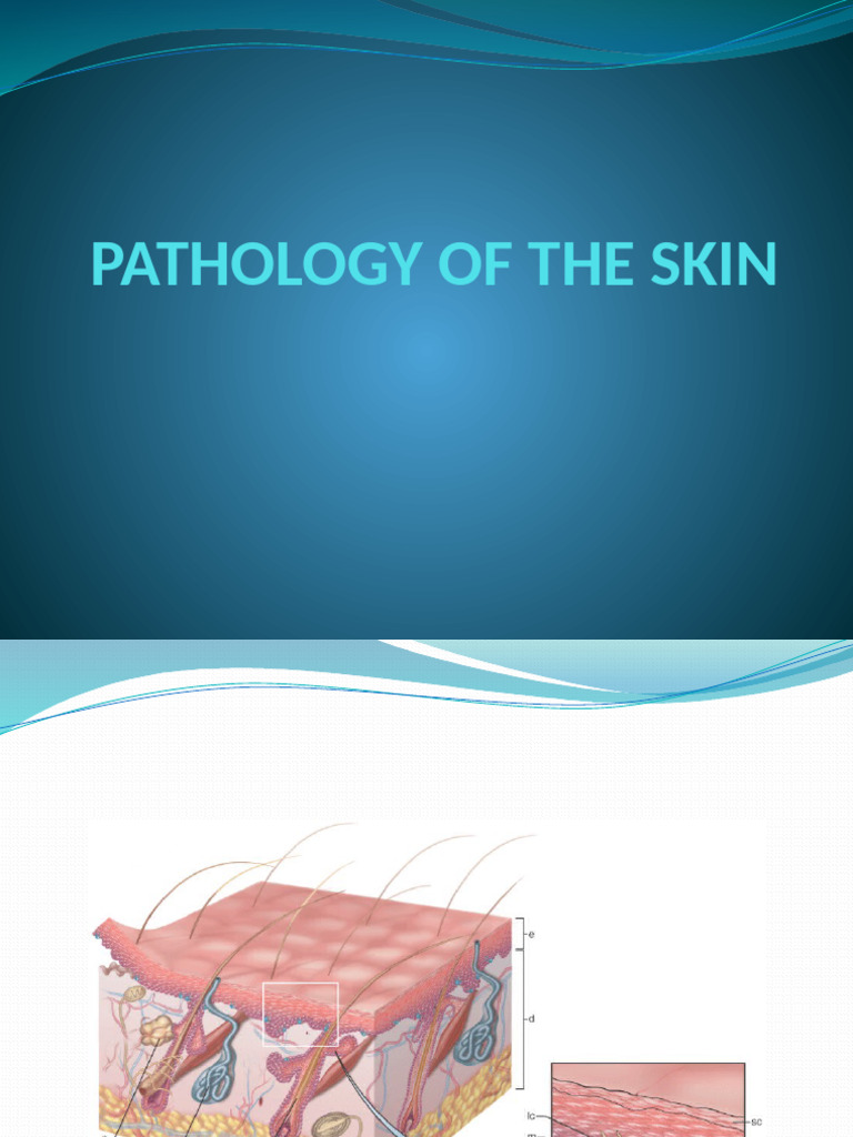 33 Pathology Of Skin Pdf