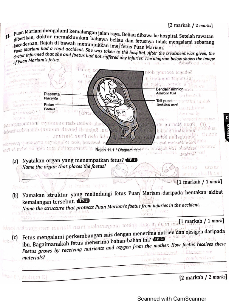 Revision Guide and Question Pregnancy | PDF