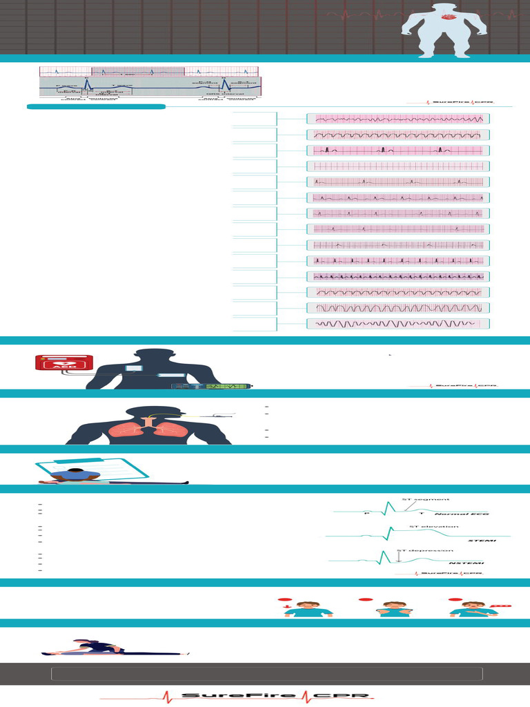 The Ultimate ACLS Study Guide Infographic SureFire CPR 2 | PDF