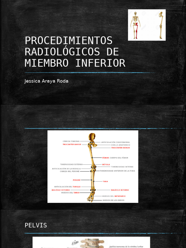 Miembro Inferior | PDF
