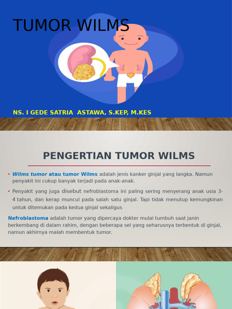 Tumor Wilms | PDF