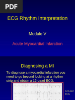 Ecg Basics Acute Myocardial Infarction Pdf Electrocardiography
