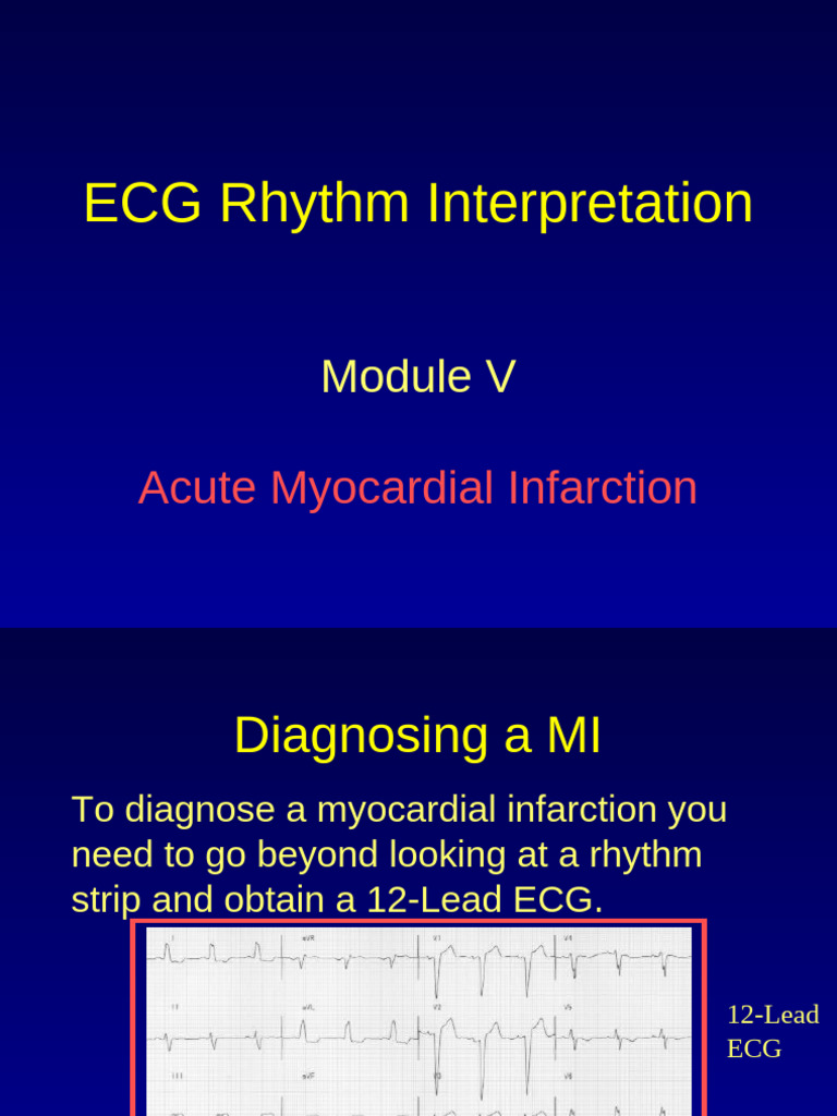 Module 5 Ecg | PDF | Electrocardiography | Internal Medicine