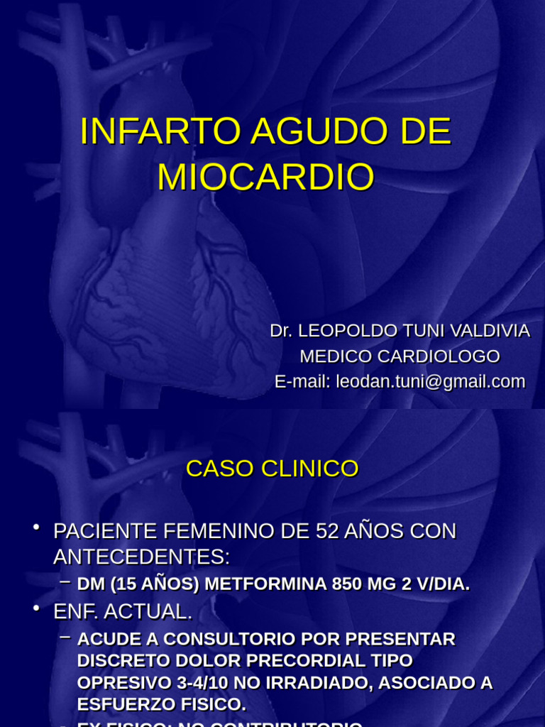 Infarto Agudo de Miocardio 23 | PDF | Infarto de miocardio | Medicina ...