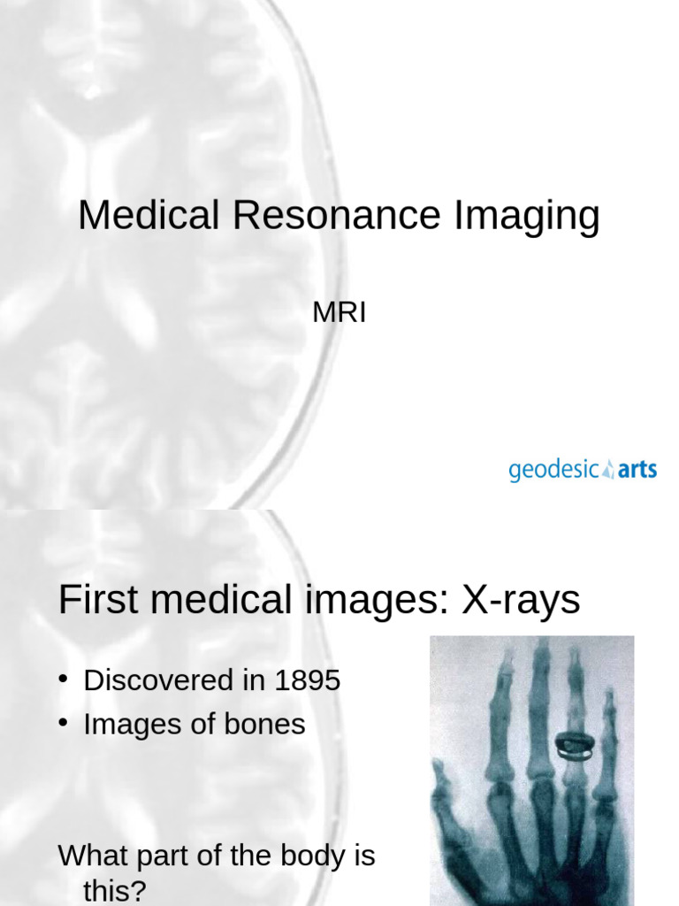 Introduction to Magnetic Resonance Imaging | PDF | Science ...