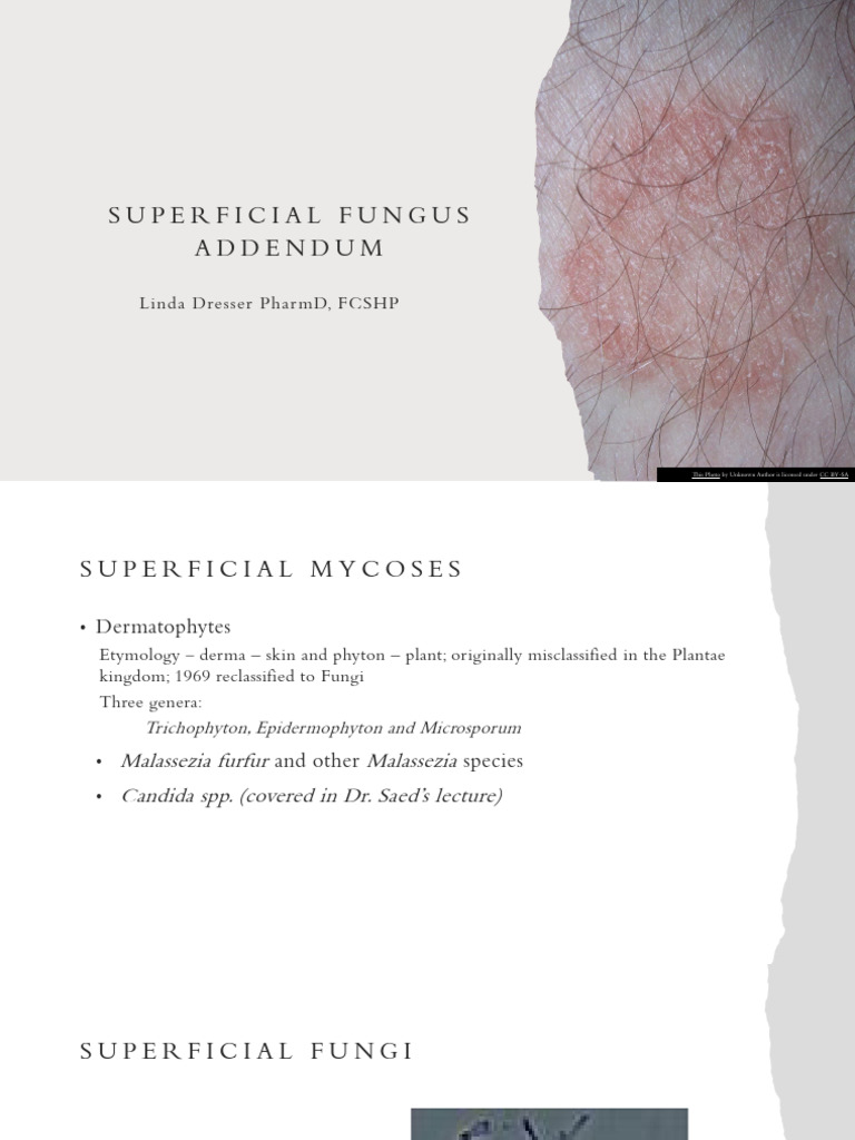 Superficial Fungal Infections Overview | PDF | Microbiology | Fungus